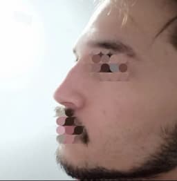 CRVVVYS